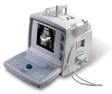  Portable Ultrasound Scanner (Портативный ультразвуковой сканер)