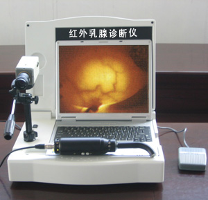  Portable LCD Infrared Mammography Examination (with Software) ( Portable LCD Infrared Mammography Examination (with Software))