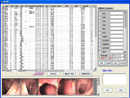  Uteroscope Image Workstation (Uteroscope Image Workstation)