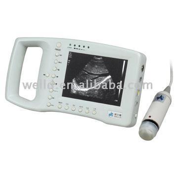  Handle Palm B Mode Ultrasound Scanner ( Handle Palm B Mode Ultrasound Scanner)