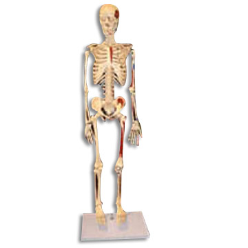 Modell Skeleton (Modell Skeleton)