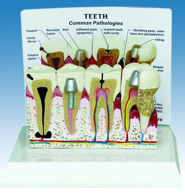  Teeth Model with Description Plate (Dents modèles avec Description Plate)